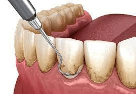 Periodontia